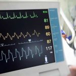 Sistemas de monitoreo en casa para falla cardiaca